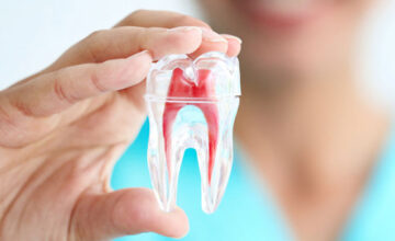 Tất tần tật những điều bạn cần biết về điều trị tủy răng