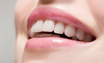Tiêu chuẩn của một hàm răng đẹp là gì?