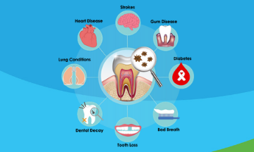 The correlation between oral health and overall health